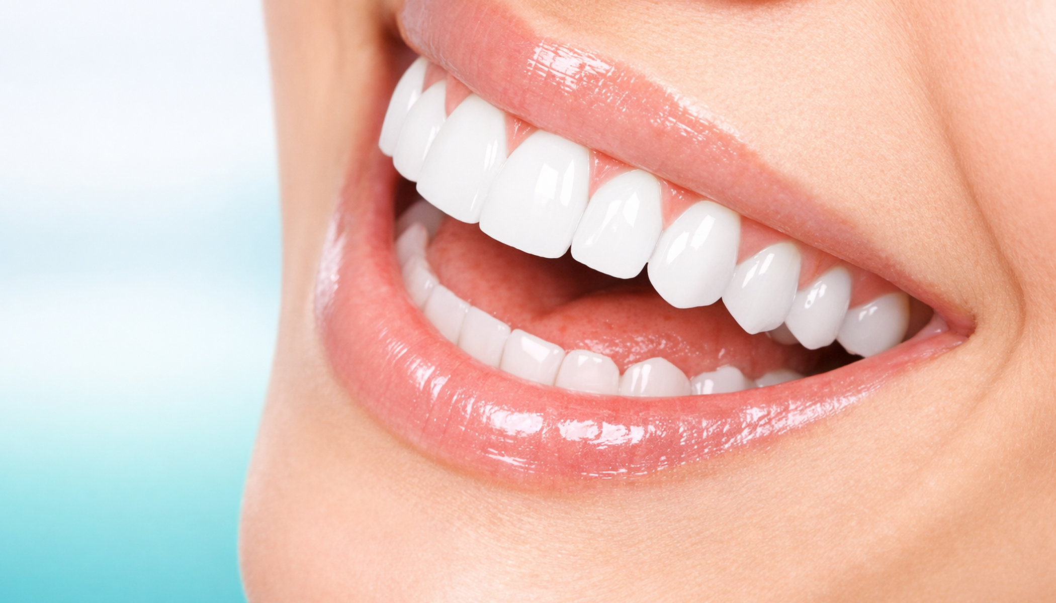 Teeth Whitening